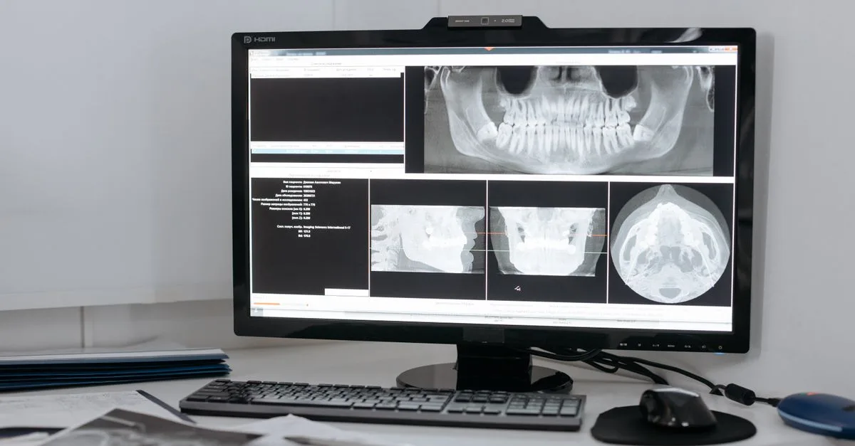 guide complet pour l'élimination sécurisée des rayons x : méthodes, précautions et réglementation en vigueur pour un traitement responsable des déchets radiographiques.